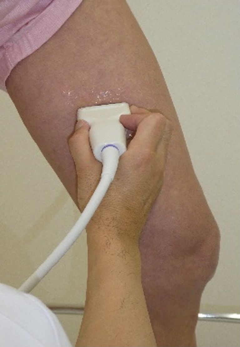下肢静脈エコー検査